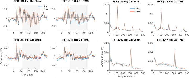 recerca_FFR-TMS_