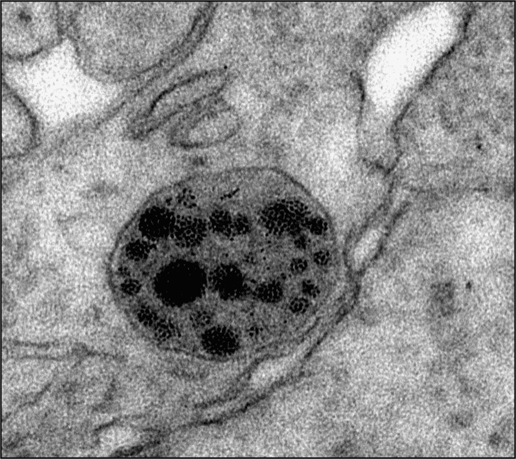 Imagen de microscopia electrónica de un área del cerebro de un ratón donde se ve un cuerpo multivesicular, que contiene en su interior la proteína mutante huntingtina, a punto de fusionarse con la membrana plasmática.